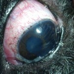age-relatetd-iris-atrophy