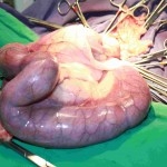 gebaermuttervereiterung-gefuelltes-uterushorn-111-150x150