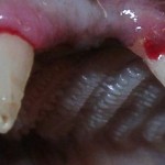 FORLS (feline odontoklastic resorptive leasions syndrom) 