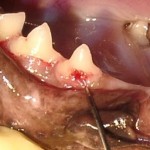 Der eigene Körper attackiert den Zahn und Zahnhalteapparat. Odontoklasten bauen die Zahnsubstanz ab.