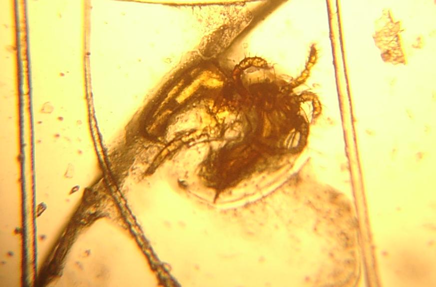 Wie Sehen Wurmer Im Stuhl Aus Bilder