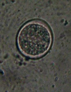 Protozoen durchlaufen verschiedene tadien. Toxoplasma Oozyste noch nicht nichtinfektiös.